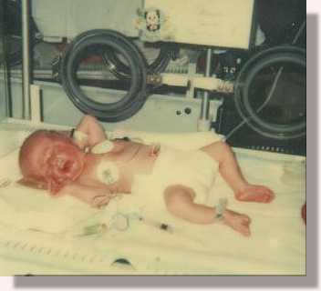 premature baby